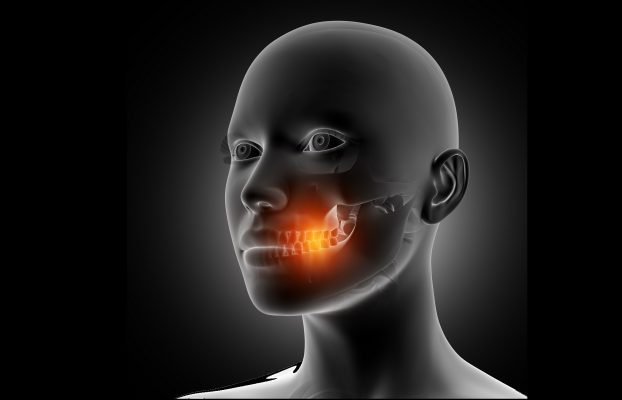 Everything About Zygoma Complex Fracture
