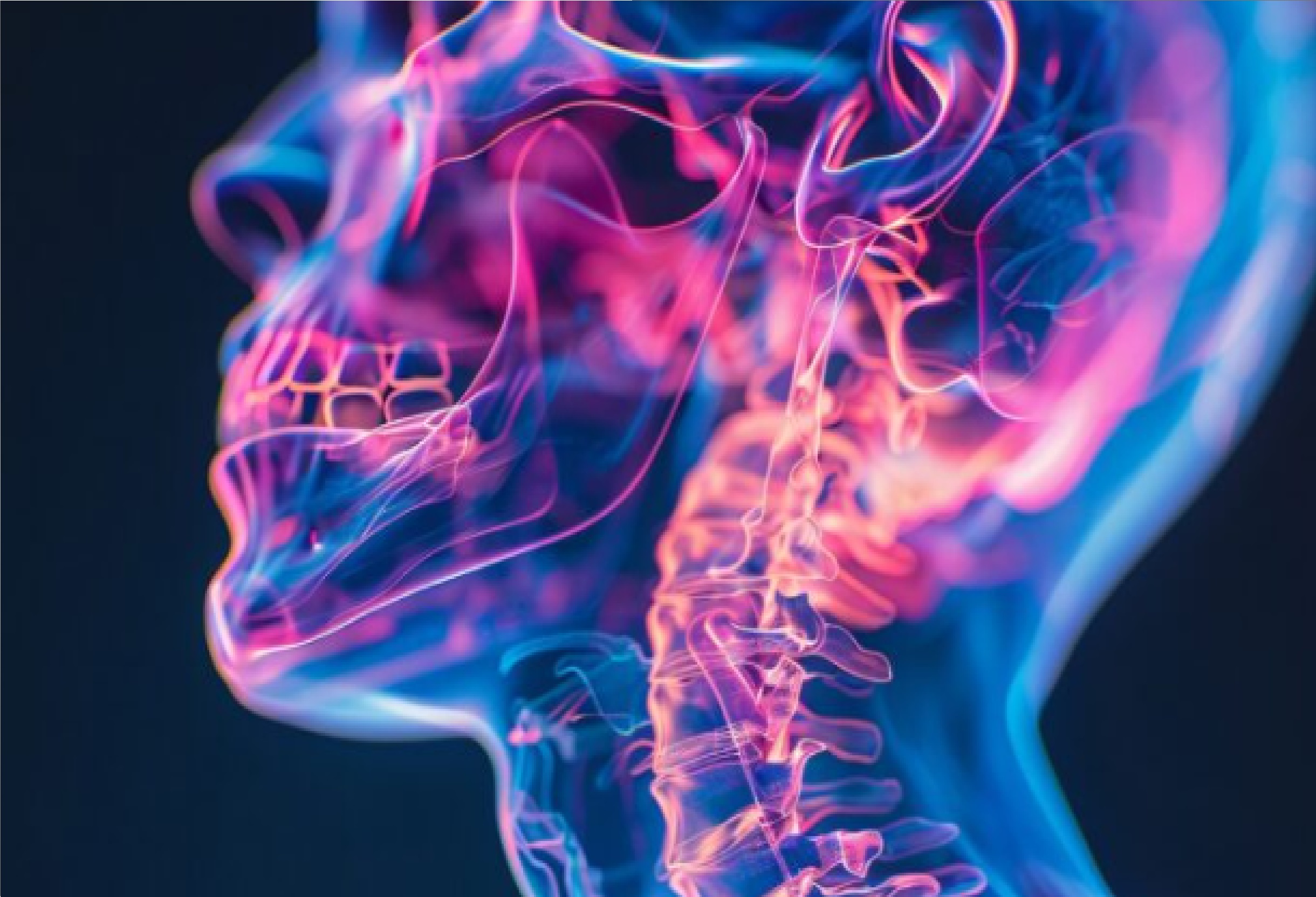 Everything About Zygoma Complex Fracture