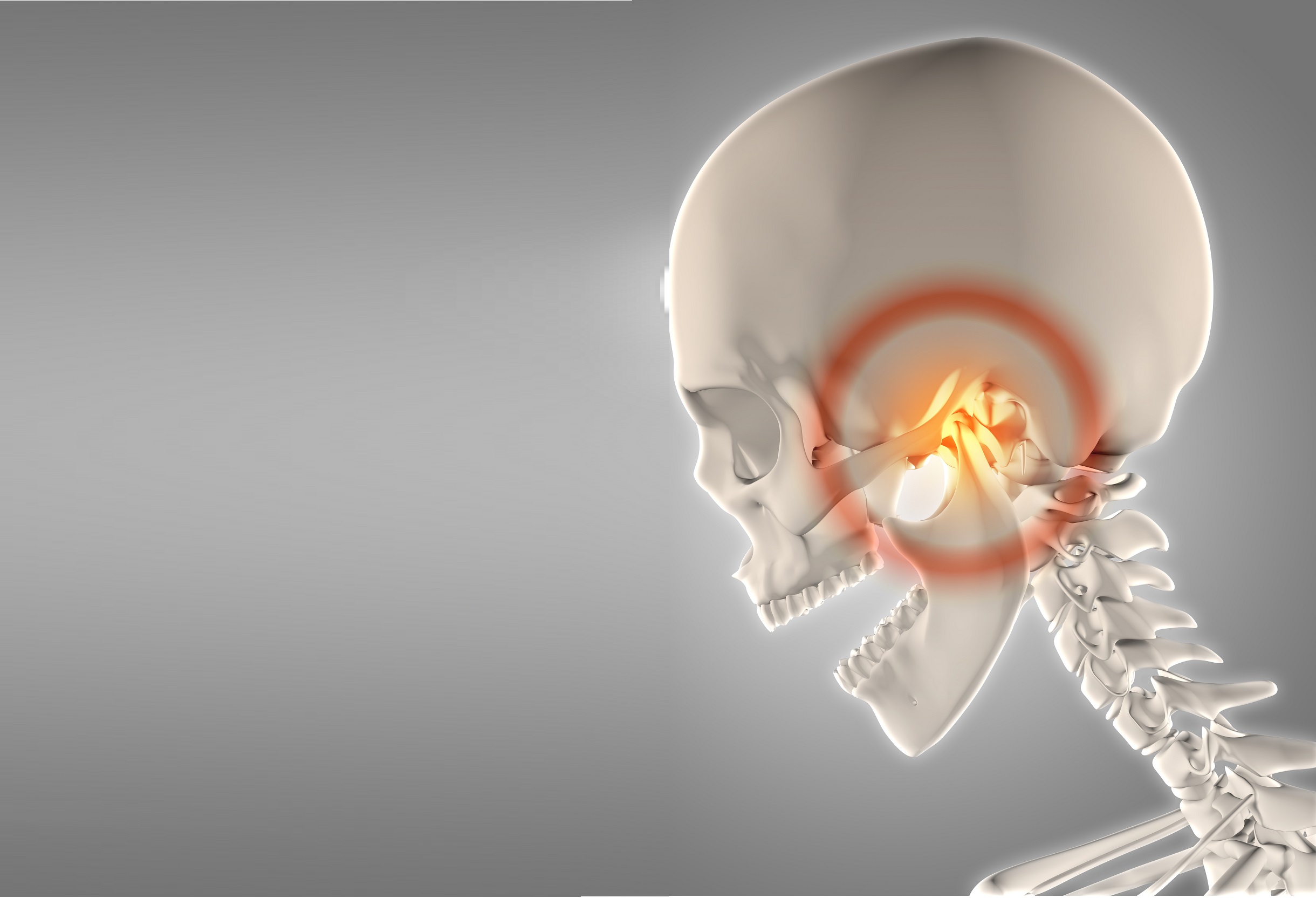 zygoma-complex-fracture
