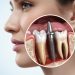 What Is an Endosteal Implant (Intraosseous) Dental Implant