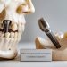 Zygomatic Dental Implants vs Traditional Implants