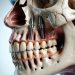 2026 Zygomatic Implants Cost: Realistic Prices, Factors, and Smart Ways to Save