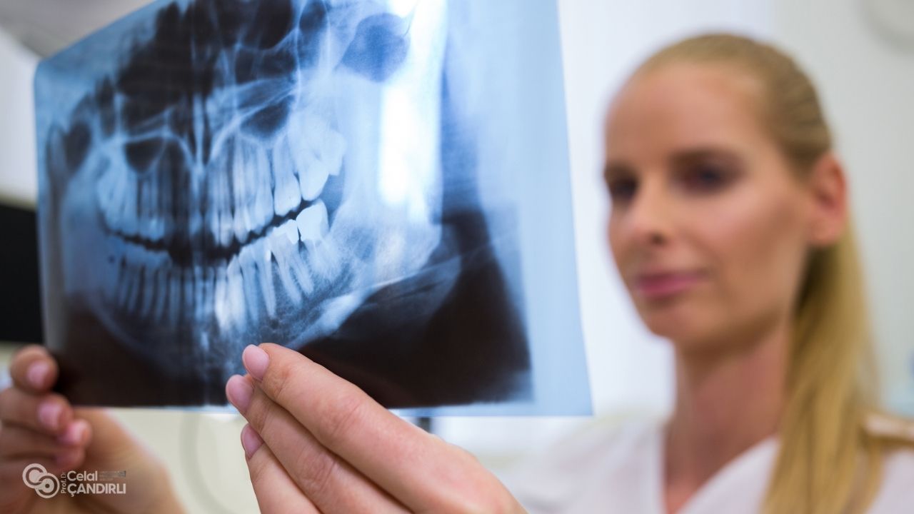 CBCT Scans and Guided Surgical Techniques