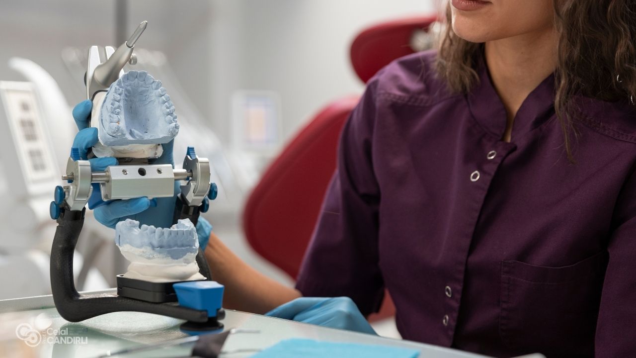 When Low Jawbone Density Leads to Zygomatic Implant Recommendation