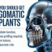 Why You Should Get Zygomatic Implants 2026