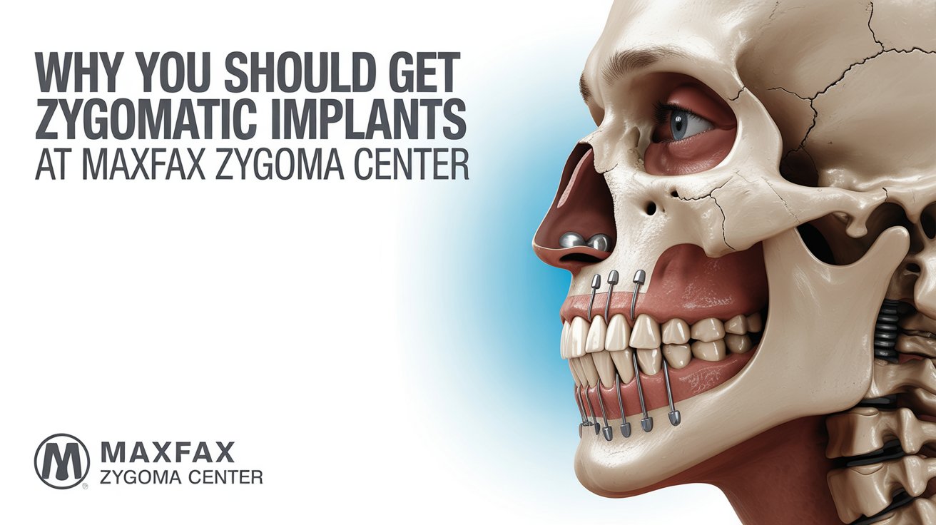 Why You Should Get Zygomatic Implants at Maxfax Zygoma Center