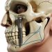 Postoperative Care After Zygomatic Implants (Lifespan of Zygomatic Implants)